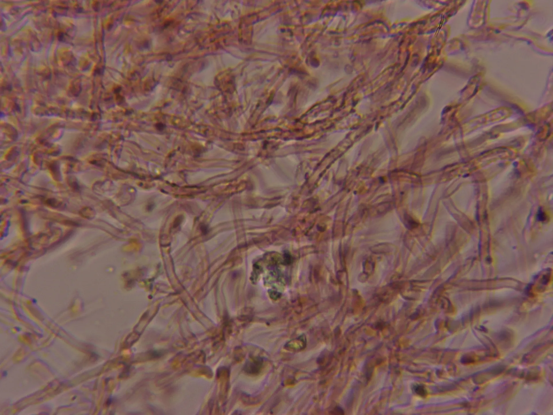 Microscopía de Skeletocutis stellae - 10 - Hifas contexto